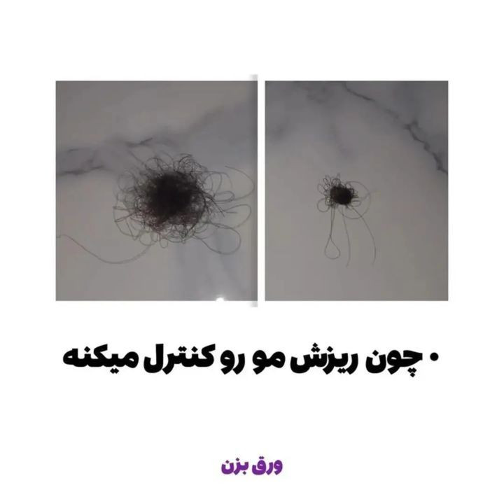 تونیک هرفرند(قطع صد درصدی ریزش مو و افزایش رشد)
