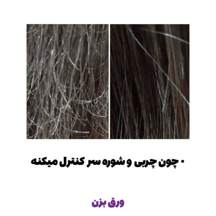تونیک هرفرند(قطع صد درصدی ریزش مو و افزایش رشد)