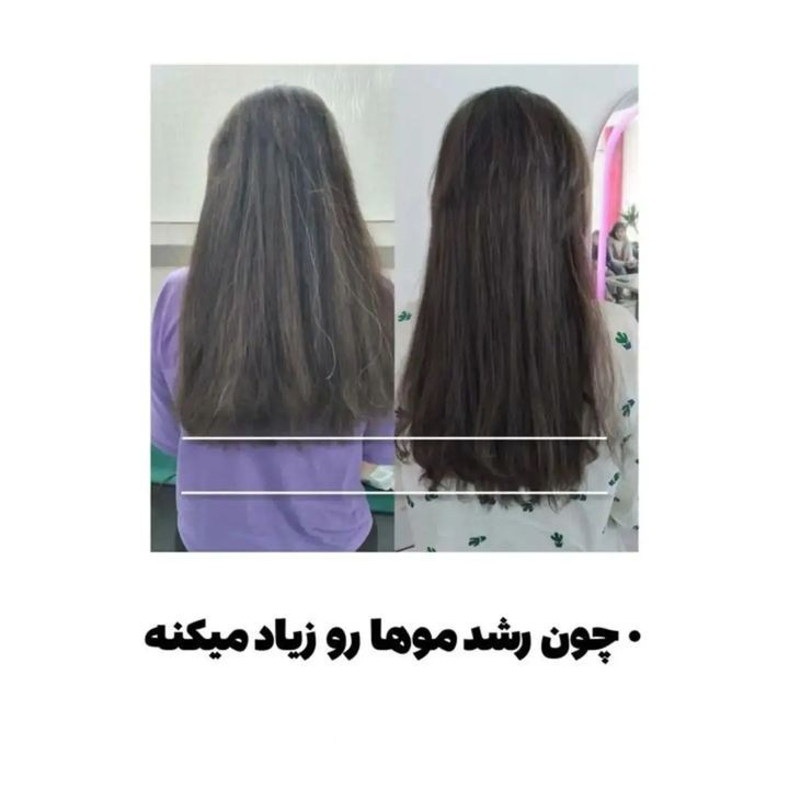 تونیک هرفرند(قطع صد درصدی ریزش مو و افزایش رشد)